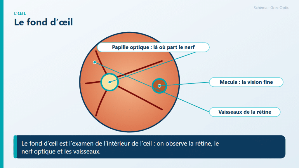 Schéma : Le fond d’œil