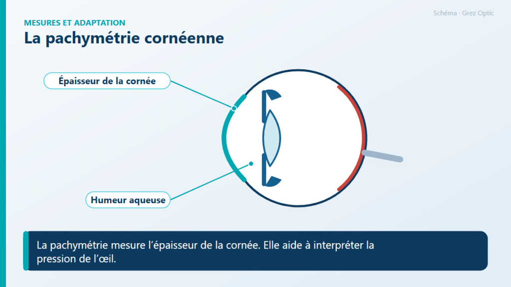 Schéma : La pachymétrie cornéenne
