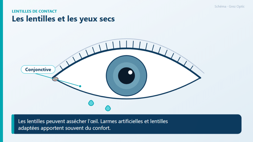Schéma : Les lentilles et les yeux secs