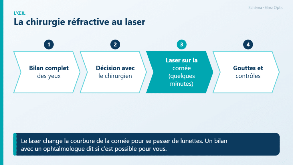 Schéma : La chirurgie réfractive au laser